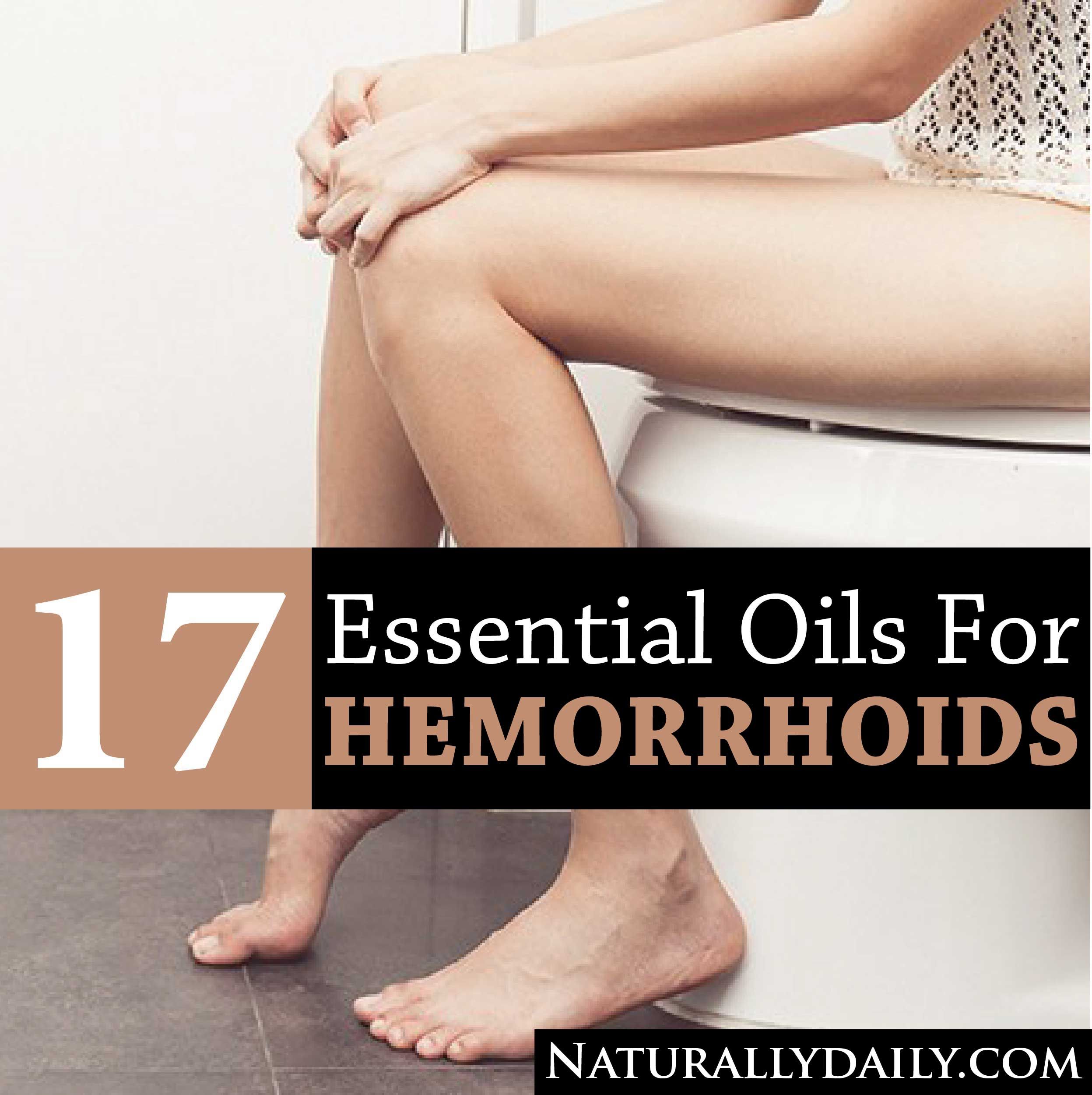 17 Essential Oils for Hemorrhoids That Really Work